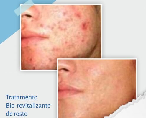 Bio-revitalizante de rosto 2