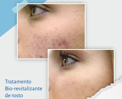 Bio-revitalizante de rosto 3