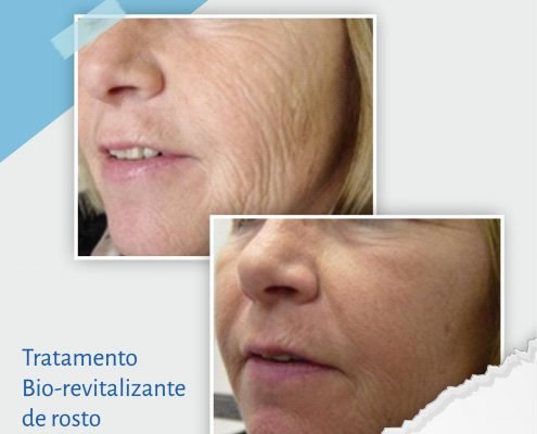 Bio-revitalizante de rosto
